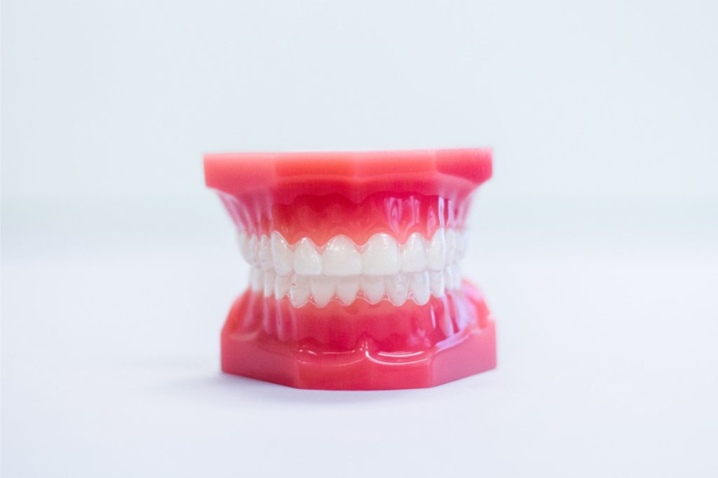 Invisalign&reg; FAQs,invisalign sammamish,invisalign issaquah,invisalign cost,invisalign near me