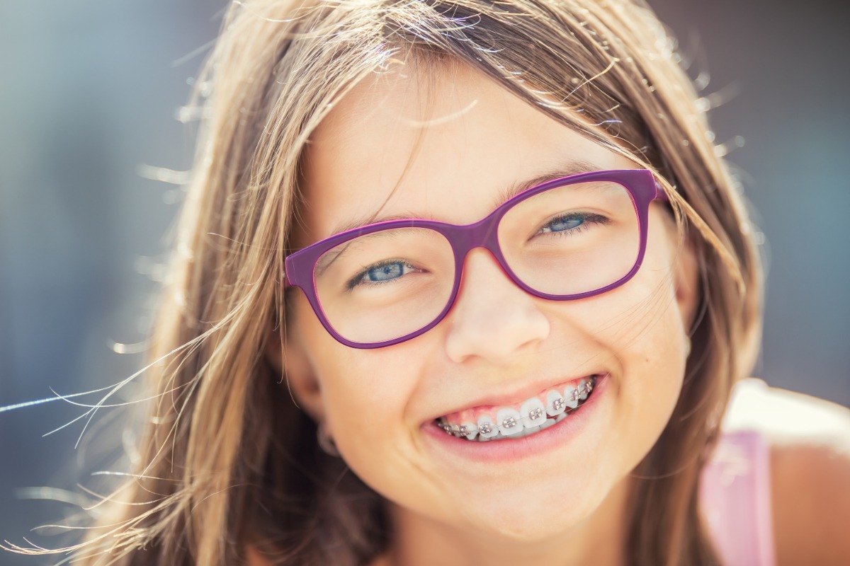How Can Orthodontics Help a Gummy Smile?