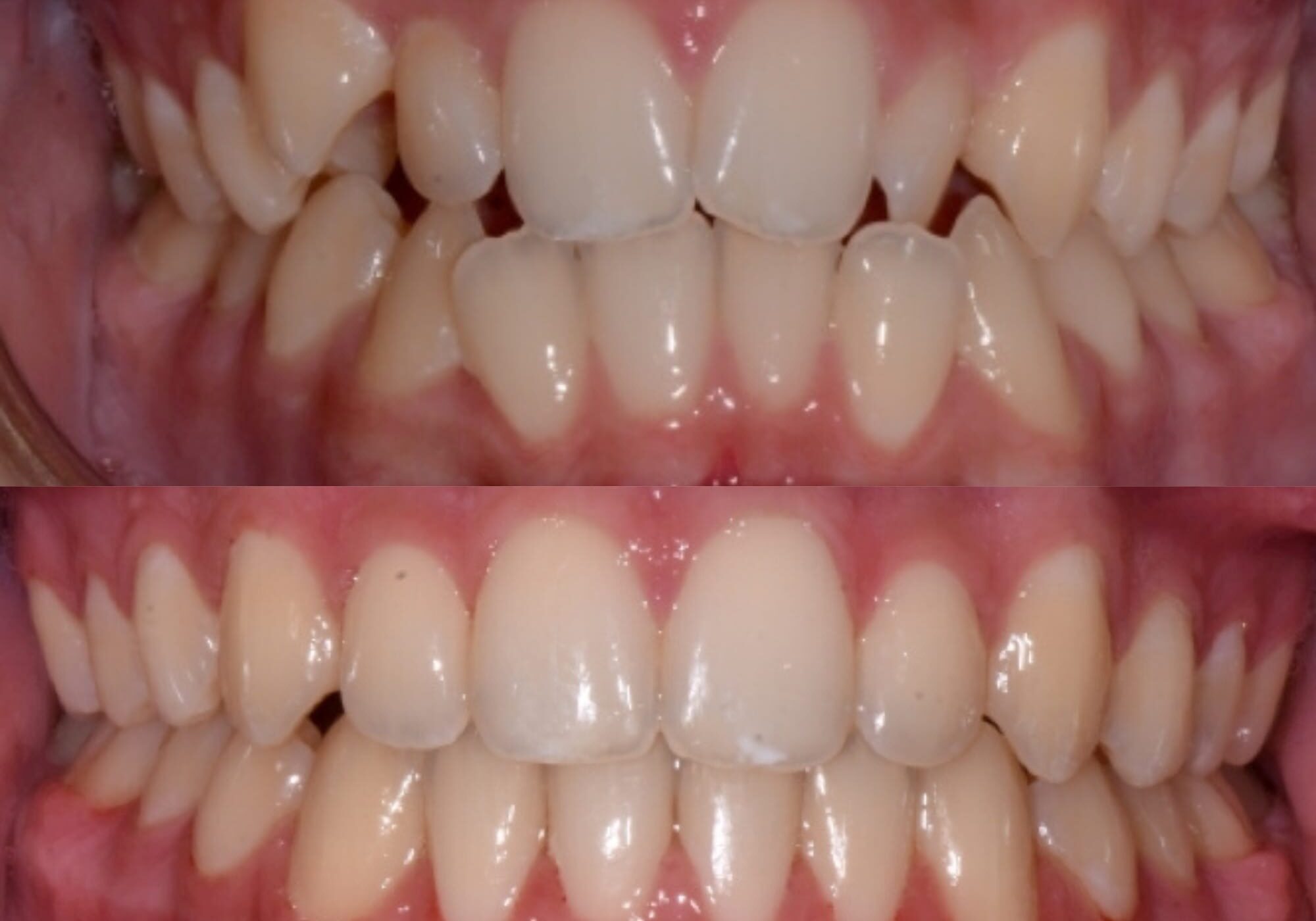 Manley Orthodotics Before and after