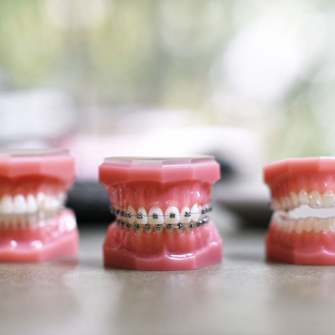 Christian Manley Orthodontics tooth models